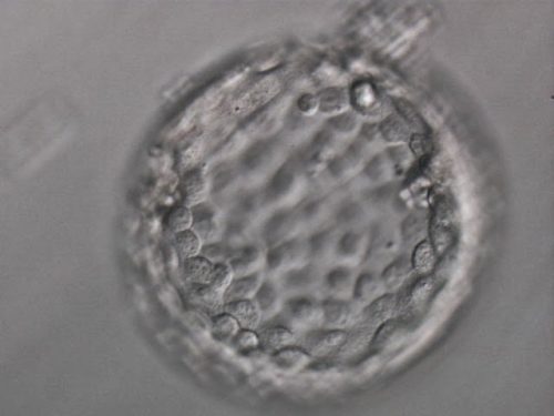 採卵からの胚盤胞はいかに？着床率を考えての末に凍結は・・・[妊活レポート]